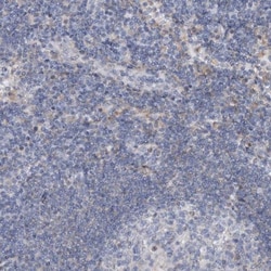 AGXT2 Antibody, Novus Biologicals:Antibodies:Primary Antibodies