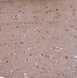 AGXT2L1 Antibody, Novus Biologicals 0.1mL; Unlabeled:Antibodies, Polyclonal