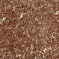 AHDC1 Antibody, Novus Biologicals 0.1mL; Unlabeled:Antibodies, Polyclonal