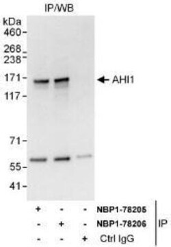 AHI1 Antibody, Novus Biologicals 0.1mg; Unlabeled:Antibodies, Polyclonal