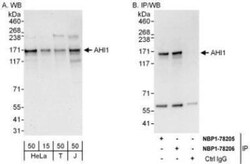AHI1 Antibody, Novus Biologicals 0.1mg; Unlabeled:Antibodies, Polyclonal
