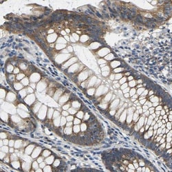 AHNAK Antibody, Novus Biologicals:Antibodies:Primary Antibodies