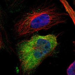 AHNAK2 Antibody, Novus Biologicals 25 &mu;L; Unlabeled:Antibodies, Polyclonal