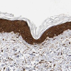 AHNAK2 Antibody, Novus Biologicals 25 &mu;L; Unlabeled:Antibodies, Polyclonal