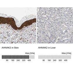AHNAK2 Antibody, Novus Biologicals 25 &mu;L; Unlabeled:Antibodies, Polyclonal