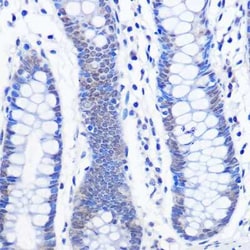 AHR Rabbit anti-Human, Clone: 2Z5Y8, Novus Biologicals 100 &mu;g | Buy Online | Novus Biologicals | Fisher Scientific