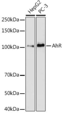 AHR Rabbit anti-Human, Clone: 2Z5Y8, Novus Biologicals 100 &mu;g | Buy Online | Novus Biologicals | Fisher Scientific
