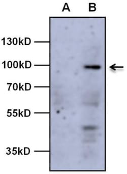 AHR Antibody (RPT9) - BSA Free, Novus Biologicals 0.1mL; Unlabeled:Antibodies,