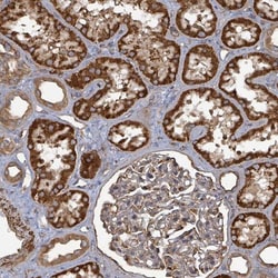 AHSA2 Antibody, Novus Biologicals:Antibodies:Primary Antibodies