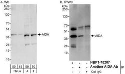 AIDA Antibody, Novus Biologicals 0.1 mL | Buy Online | Novus Biologicals | Fisher Scientific