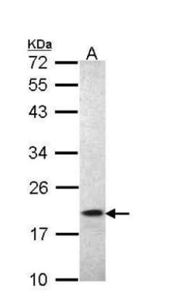 AIF-1/Iba1 Antibody, Novus Biologicals 0.1mg; Unlabeled:Antibodies, Polyclonal