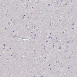 AIF Antibody, Novus Biologicals 0.1mL; Unlabeled:Antibodies, Polyclonal