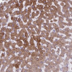 AIG1 Antibody, Novus Biologicals 25 &mu;L, Unlabeled:Antibodies, Polyclonal