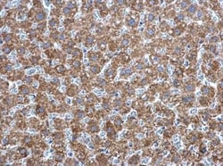AK2 Antibody, Novus Biologicals 0.1mg; Unlabeled:Antibodies, Polyclonal