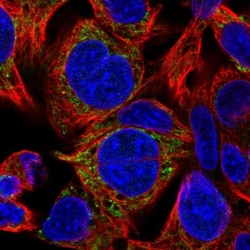 AK3L1 Antibody, Novus Biologicals 0.1mL; Unlabeled:Antibodies, Polyclonal