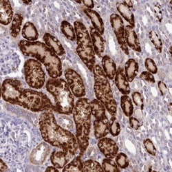 AK3L1 Antibody, Novus Biologicals 0.1mL; Unlabeled:Antibodies, Polyclonal