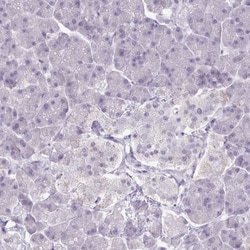 AK3L1 Antibody, Novus Biologicals 0.1mL; Unlabeled:Antibodies, Polyclonal