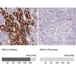 AK3L1 Antibody, Novus Biologicals 0.1mL; Unlabeled:Antibodies, Polyclonal