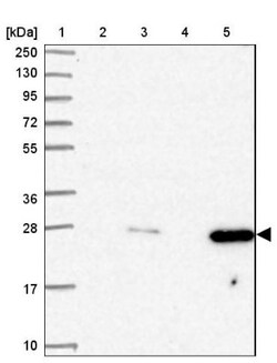 AK3L1 Antibody, Novus Biologicals 0.1mL; Unlabeled:Antibodies, Polyclonal
