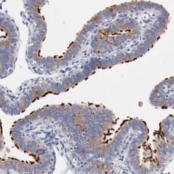 AK7 Antibody, Novus Biologicals 25 &mu;L; Unlabeled:Antibodies, Polyclonal