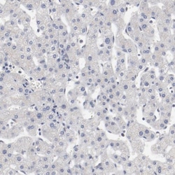 AK7 Antibody, Novus Biologicals 25 &mu;L; Unlabeled:Antibodies, Polyclonal