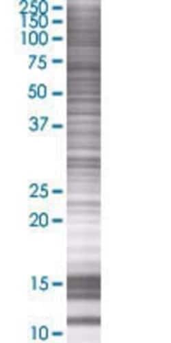 Novus Biologicals AK7 293T Cell Transient Overexpression Lysate 0.1 mL | Buy Online | Novus Biologicals&trade; | Fisher Scientific
