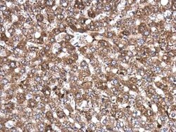 AKAP10 Antibody, Novus Biologicals 0.1mL; Unlabeled:Antibodies, Polyclonal