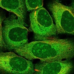 AKAP11 Antibody, Novus Biologicals 25 &mu;L | Buy Online | Novus Biologicals | Fisher Scientific