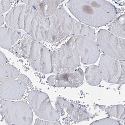 AKAP11 Antibody, Novus Biologicals 25 &mu;L | Buy Online | Novus Biologicals | Fisher Scientific