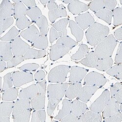 AKAP12 Antibody, Novus Biologicals:Antibodies:Primary Antibodies
