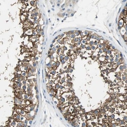 AKAP12 Antibody, Novus Biologicals:Antibodies:Primary Antibodies