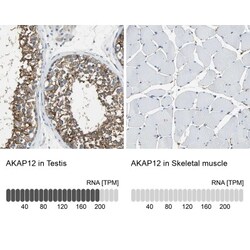 AKAP12 Antibody, Novus Biologicals:Antibodies:Primary Antibodies