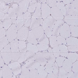 AKAP12 Antibody, Novus Biologicals 25 &mu;L, Unlabeled:Antibodies, Polyclonal