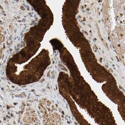 AKAP13 Antibody, Novus Biologicals:Antibodies:Primary Antibodies