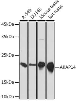 AKAP14 Rabbit anti-Human, Mouse, Rat, Clone: 4G6M5, Novus Biologicals 100 &mu;g | Buy Online | Novus Biologicals | Fisher Scientific