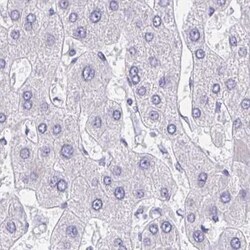 AKAP14 Antibody, Novus Biologicals 25 &mu;L, Unlabeled:Antibodies, Polyclonal