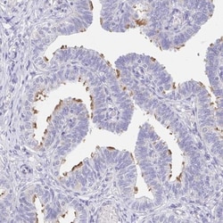AKAP14 Antibody, Novus Biologicals 25 &mu;L, Unlabeled:Antibodies, Polyclonal