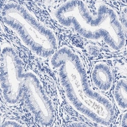 AKAP4 Antibody, Novus Biologicals:Antibodies:Primary Antibodies