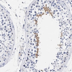 AKAP4 Antibody, Novus Biologicals:Antibodies:Primary Antibodies