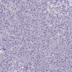 AKAP5 Antibody, Novus Biologicals 25 &mu;L, Unlabeled:Antibodies, Polyclonal