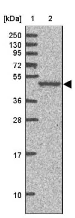 AKAP5 Antibody, Novus Biologicals 25 &mu;L, Unlabeled:Antibodies, Polyclonal