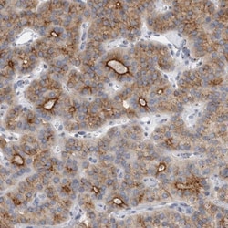 AKAP9 Antibody, Novus Biologicals 0.1mL; Unlabeled:Antibodies, Polyclonal