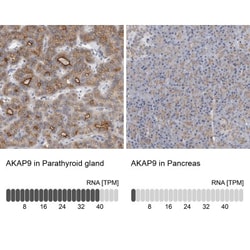 AKAP9 Antibody, Novus Biologicals 0.1mL; Unlabeled:Antibodies, Polyclonal
