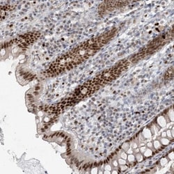 AKD1 Antibody, Novus Biologicals:Antibodies:Primary Antibodies