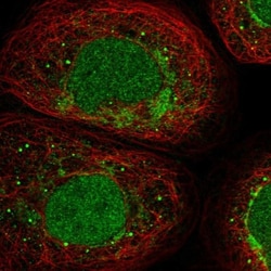 AKIP Antibody, Novus Biologicals:Antibodies:Primary Antibodies