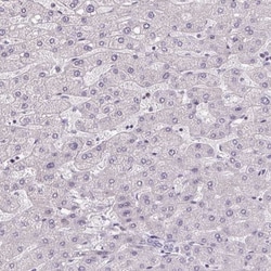 AKR1CL2 Antibody, Novus Biologicals 0.1mL; Unlabeled:Antibodies, Polyclonal