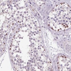 AKR1CL2 Antibody, Novus Biologicals 0.1mL; Unlabeled:Antibodies, Polyclonal