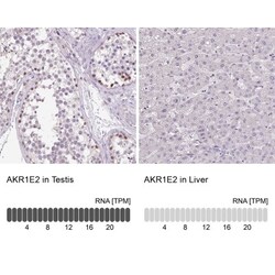 AKR1CL2 Antibody, Novus Biologicals 0.1mL; Unlabeled:Antibodies, Polyclonal