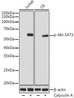 AKT1/2/3 Rabbit anti-Human, Mouse, Rat, Clone: 2E3A3, Novus Biologicals:Antibodies:Primary