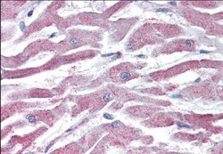 AKT3 Antibody, Novus Biologicals 0.1mg; Unlabeled:Antibodies, Polyclonal